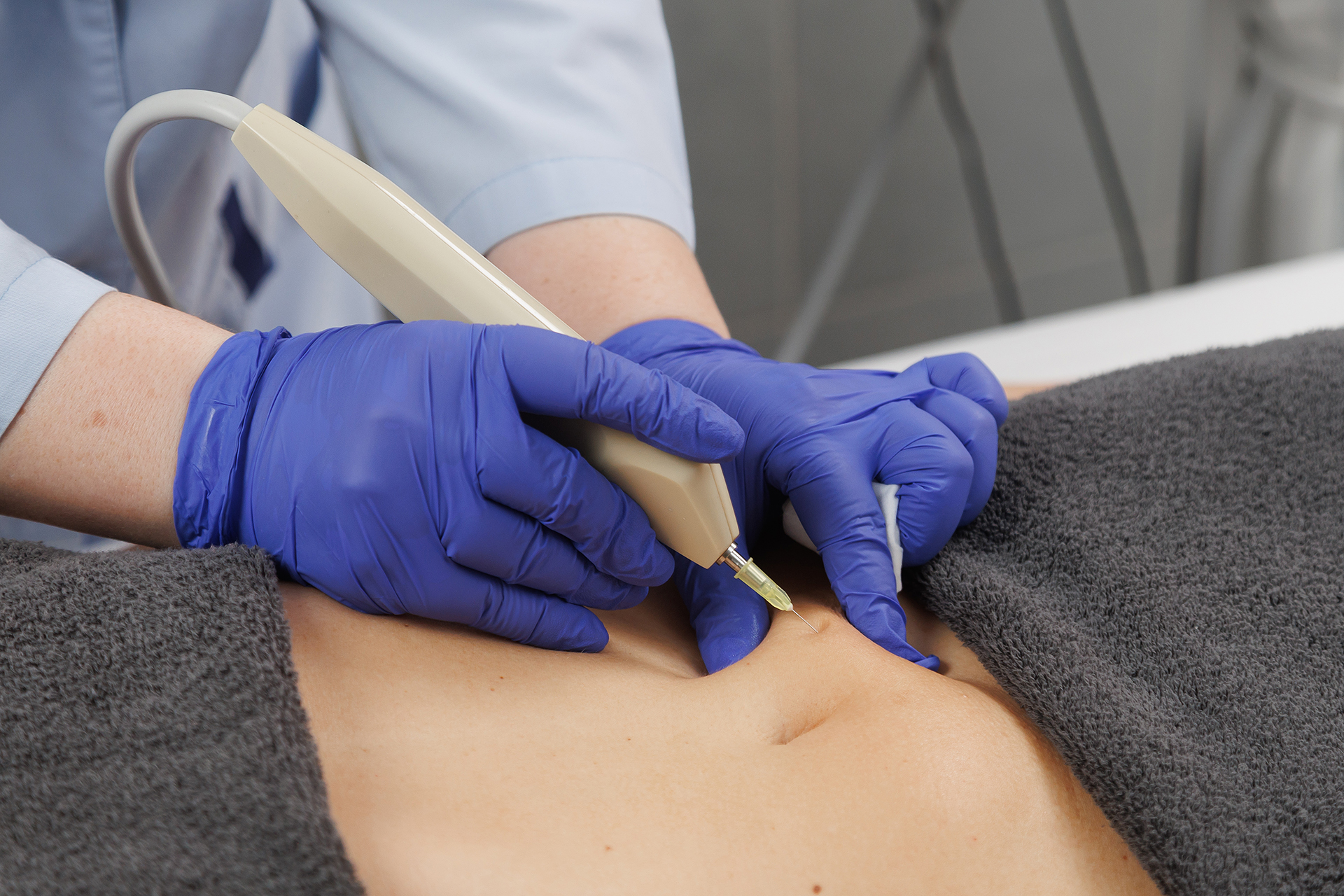 Карбокситерапия (CO2) по телу местная (подкожная) 2 Карбокситерапия (CO2) по телу местная (подкожная)